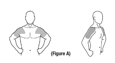 Figure A (Figure A)